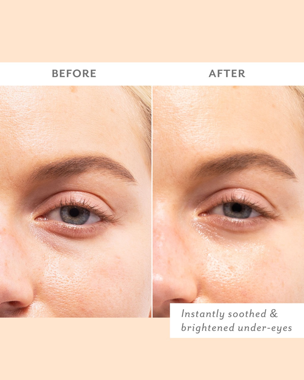 Skin Remedy Eye Patches